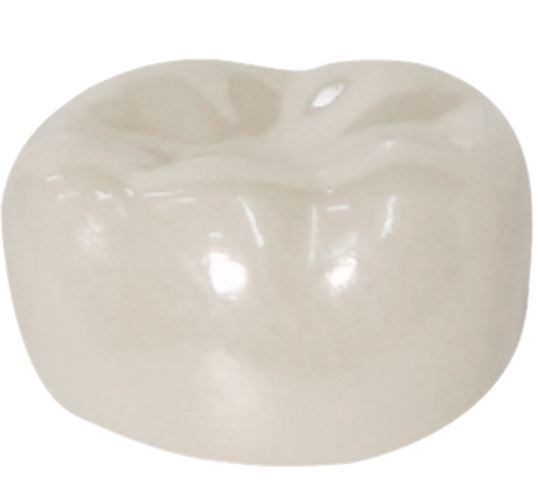 Corona zirconia nusmile posterior 1er molar y 2do molar