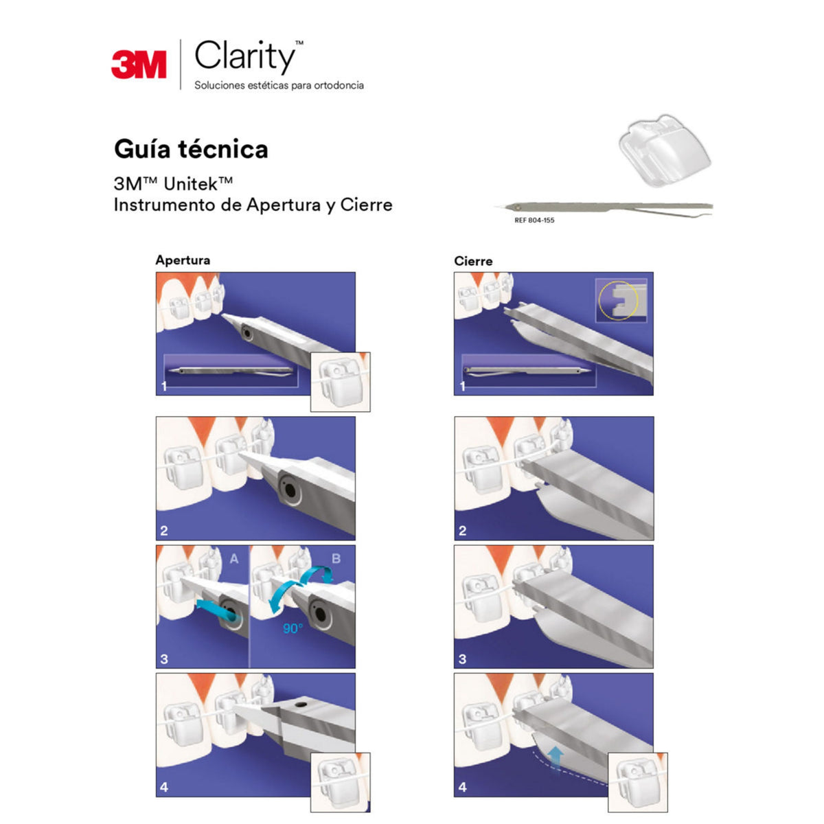 Juego de Brackets Ceramico Autoligado 3M Clarity Ultra MBT .022 55 HK (003-111) zafiro