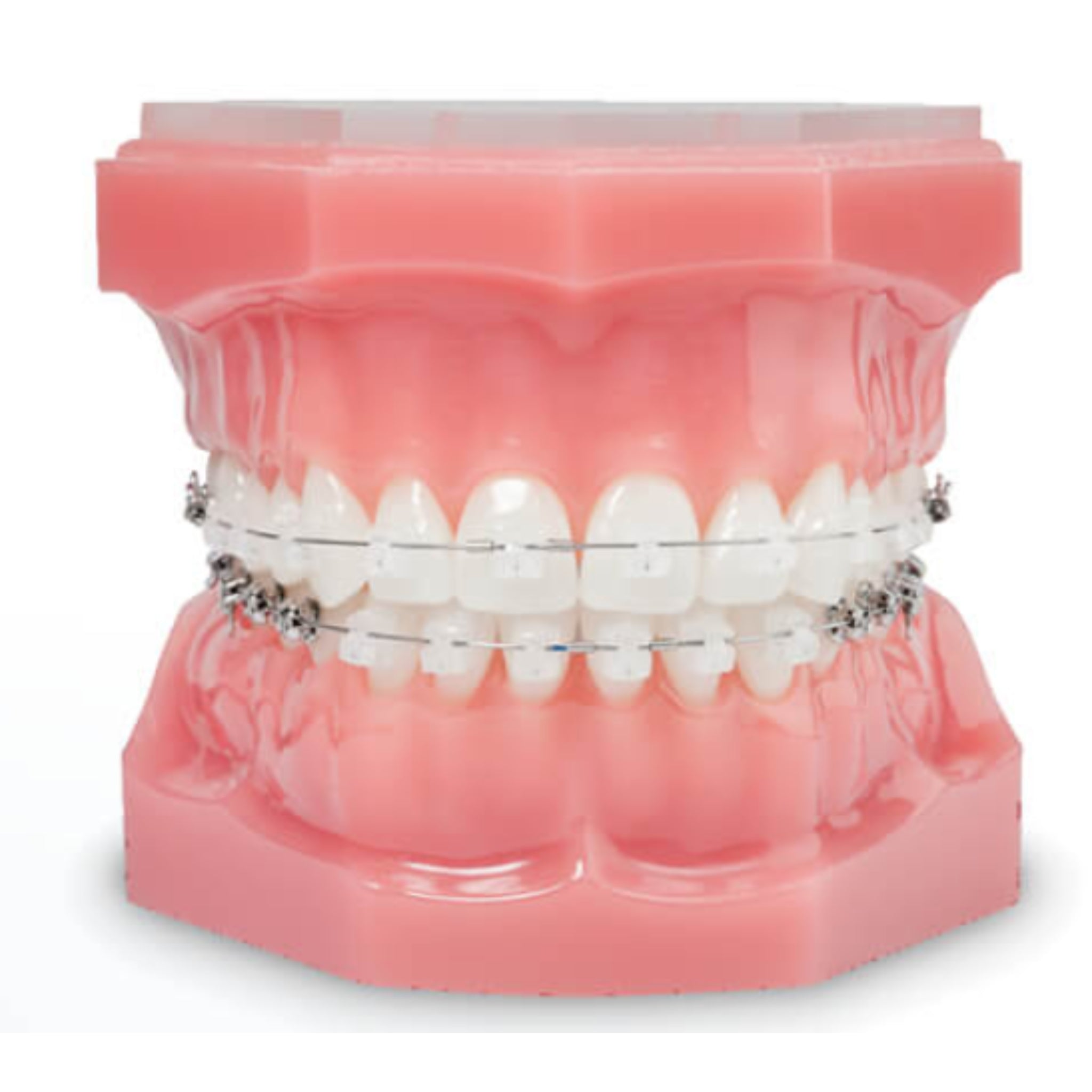 Bk ormco set damon clear 2 STD, 1 kit (20 brackets, 16 arcos y 8 tubos)