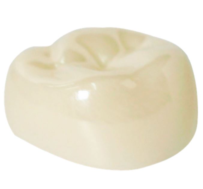 Corona zirconia nusmile posterior 1er molar y 2do molar