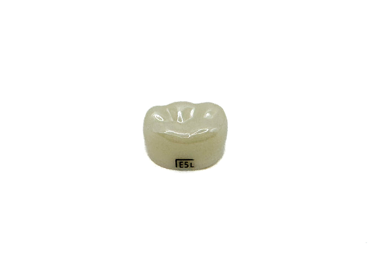 Corona zirconia nusmile posterior 1er molar y 2do molar