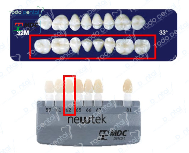 Diente new tek posterior inferior