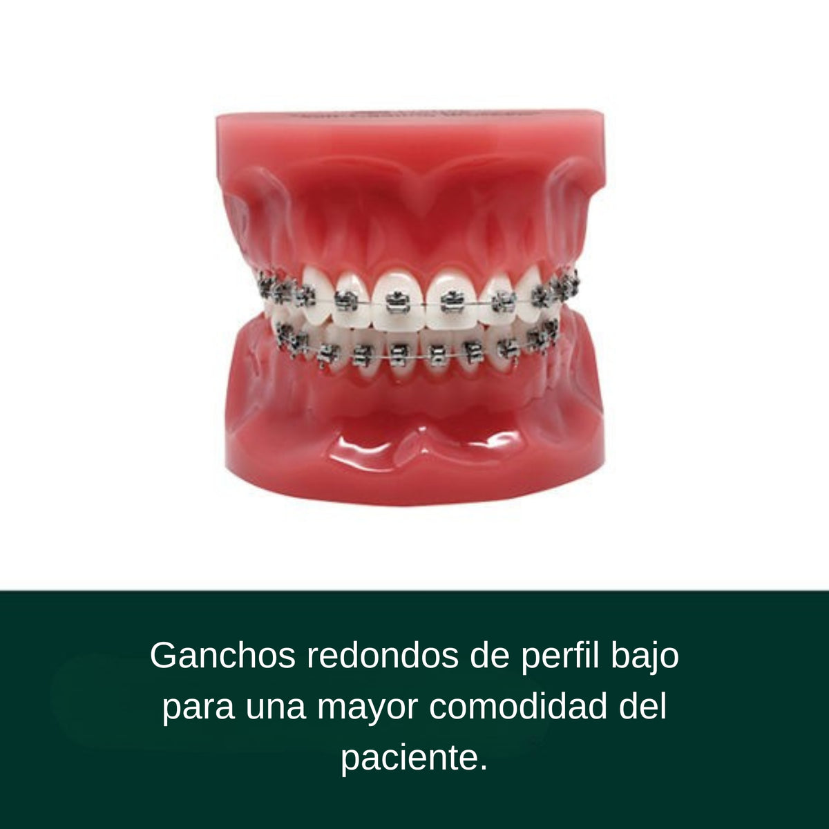 Juego de Brackets Metalico Autoligado 3M Victory Series Active SL .022 55 HK (025-127)