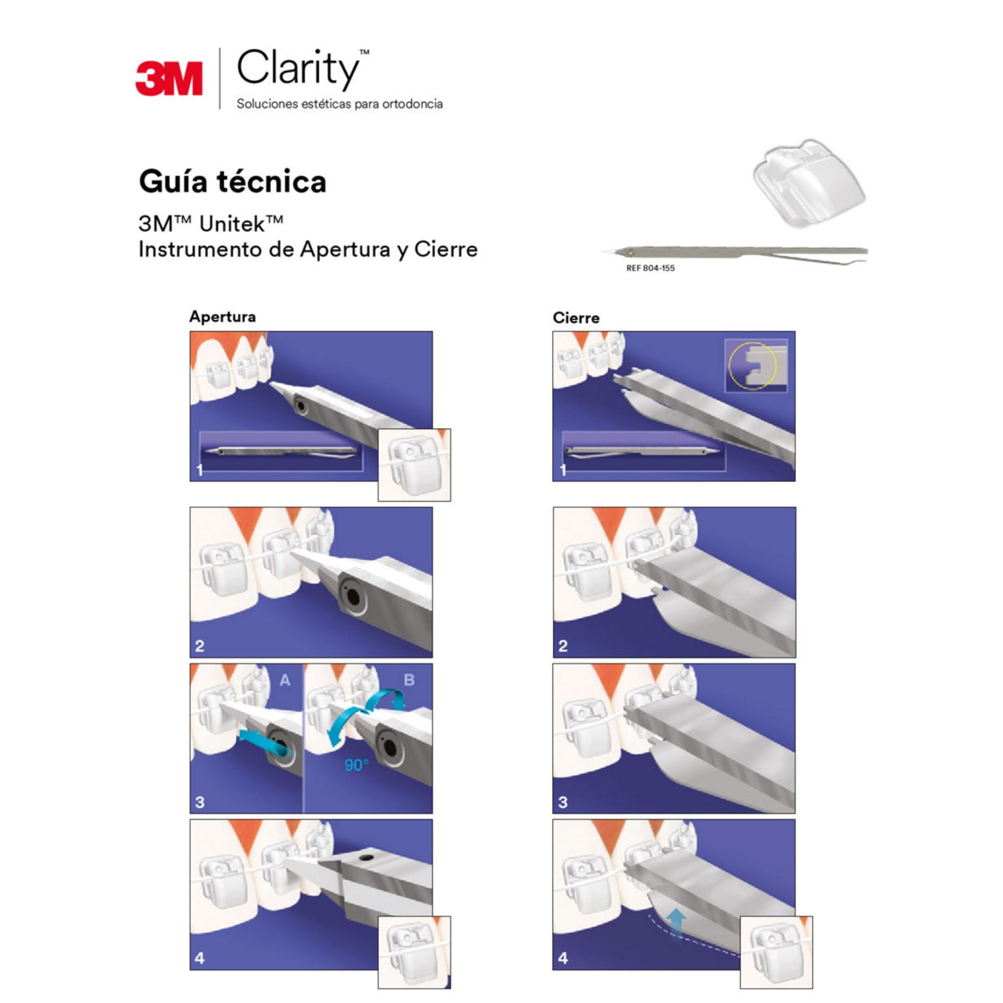 Juego de Brackets Ceramico Autoligado 3M Clarity Ultra MBT .022 55 HK (003-111)