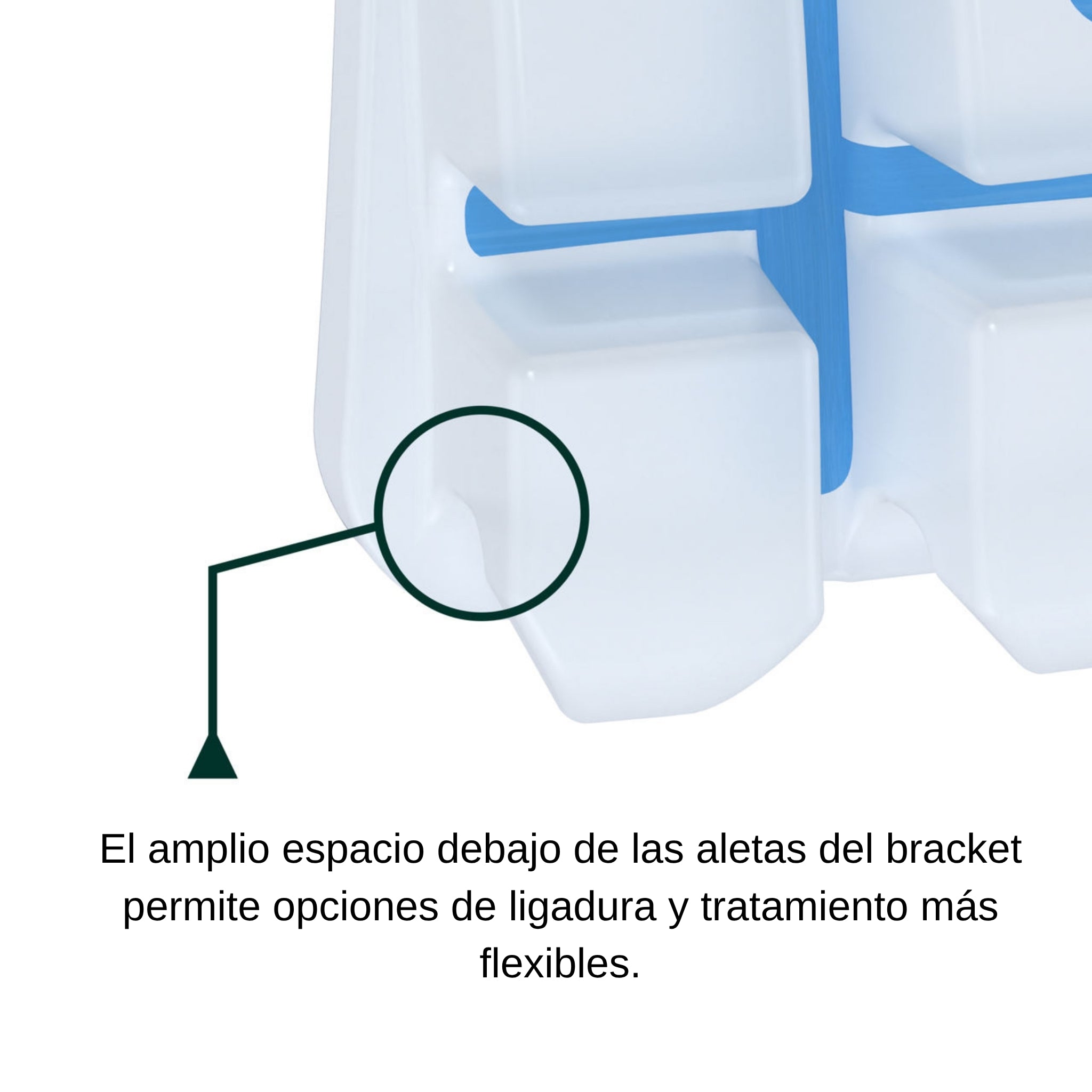Juego de Brackets Ceramico MBT .022 CG3 Clarity Advanced (006-110)
