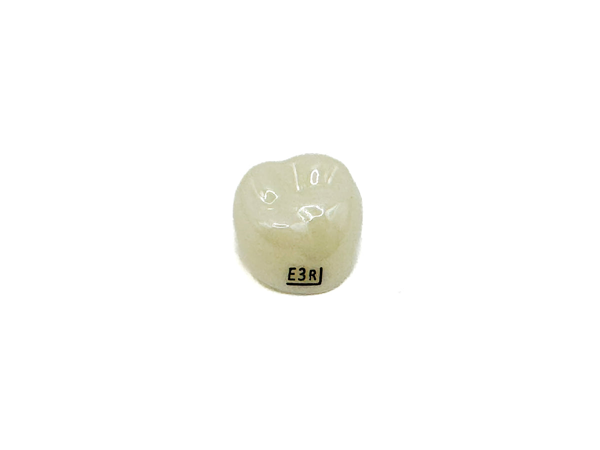 Corona zirconia nusmile posterior 1er molar y 2do molar