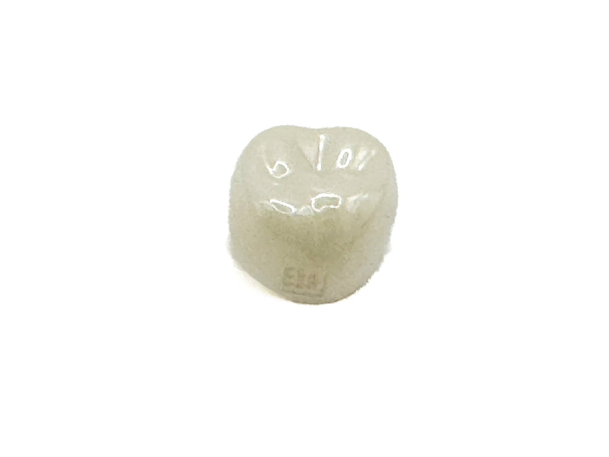 Corona zirconia nusmile posterior 1er molar y 2do molar