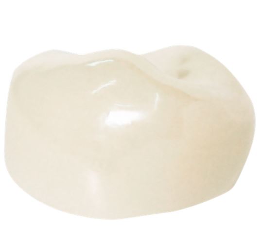 Corona zirconia nusmile posterior 1er molar y 2do molar