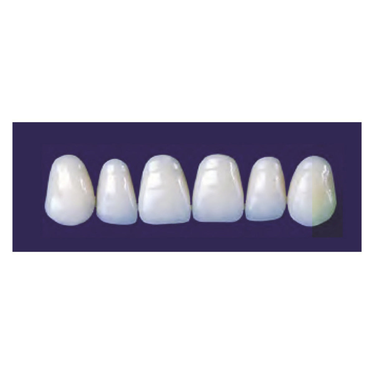 Diente new tek anterior superior — 150-137-A3.5S