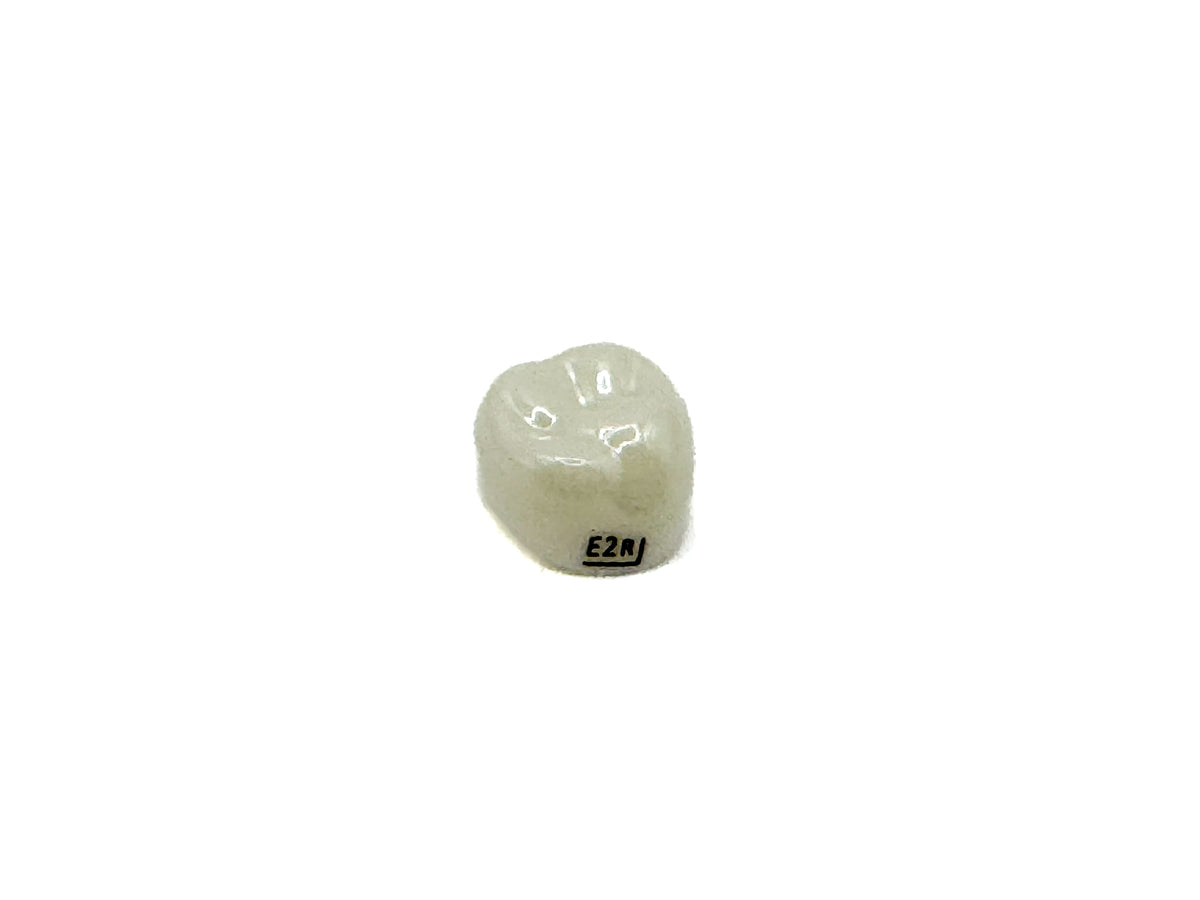 Corona zirconia nusmile posterior 1er molar y 2do molar
