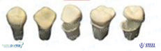 Cofres de dientes dif. Modelos (bolsa c/100 pzas.)