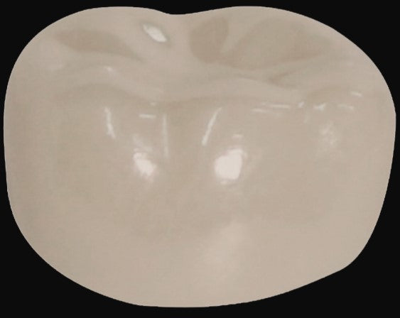 Corona de prueba nusmile 1er molar y 2do molar