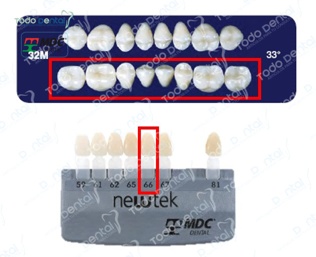 Diente new tek posterior inferior