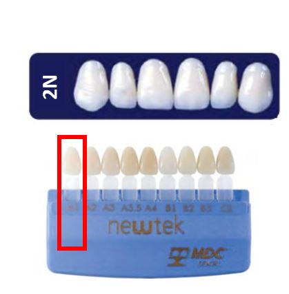Diente new tek anterior superior