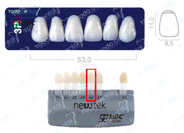 Diente new tek anterior superior