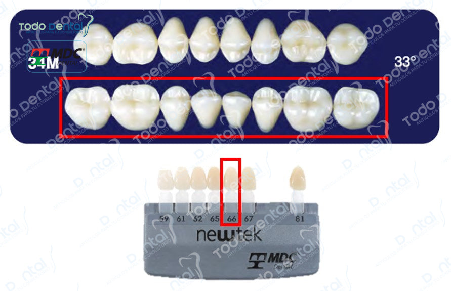 Diente new tek posterior inferior