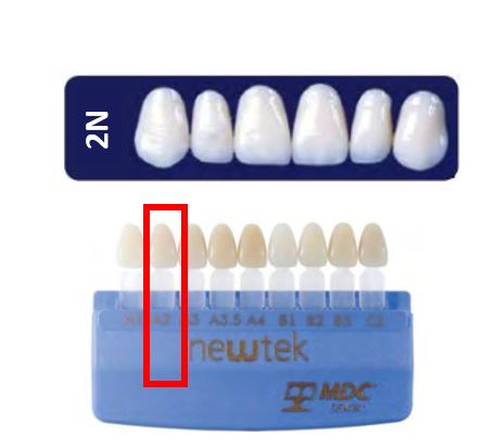 Diente new tek anterior superior