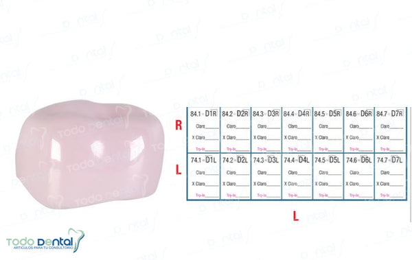 Corona de prueba nusmile 1er molar y 2do molar
